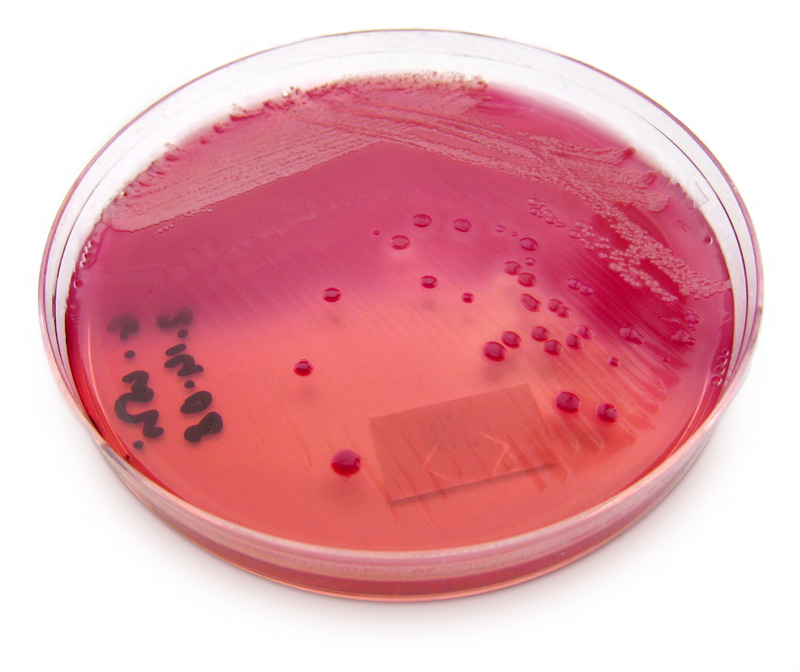 What are the characteristics of Escherichia coli bacteria?
