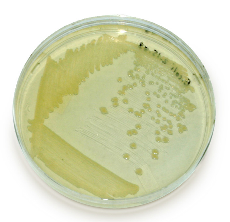 tsa agar